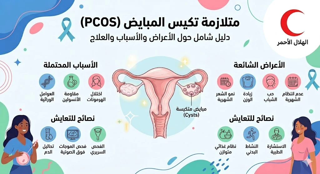 متلازمة تكيس المبايض (PCOS)